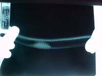 Snake xray2.jpg