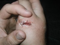 Sloth_bite_before%2ejpg[1].jpg