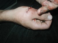 Sloth_bite_almost%2ejpg[1].jpg