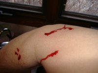 snakebite 002.jpg