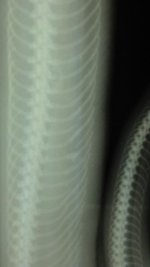 Shane Porter Closeup pic Broken Ribs 0.1 BP.jpg