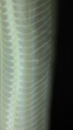 Shane Porter 0.1 BP Closeup Broken Ribs Xray.jpg