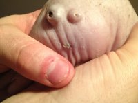 sebaceous cyst on Flats.jpg