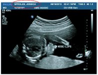 ultrasound.jpg