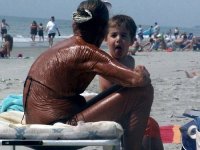sunburn.jpg