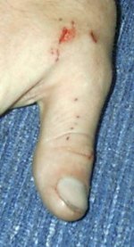 bite1.jpg