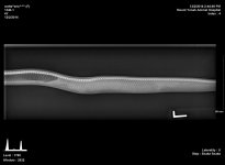 xray2.jpg