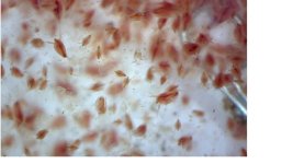 daphnia w clip.jpg