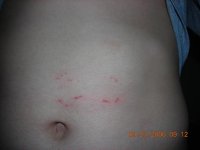 R boa bite 2.JPG