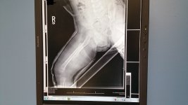 xray pic 3.jpg
