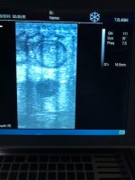 ultrasound2.jpg