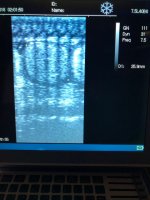 ultrasound1.jpg