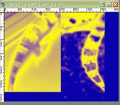 histo.jpg