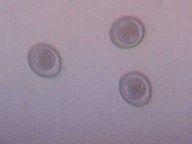 coccidia192_03.jpg