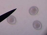 coccidia192_05.jpg