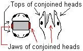 conjoinedheads.jpg