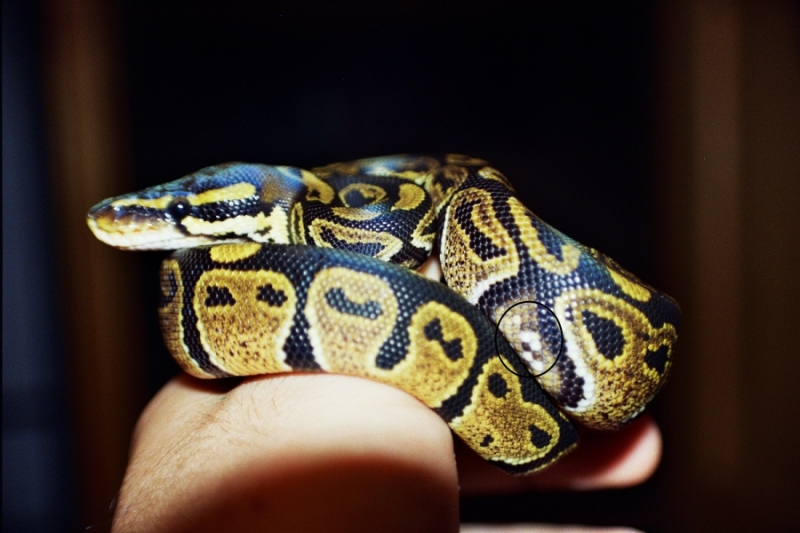 CB Normal BP