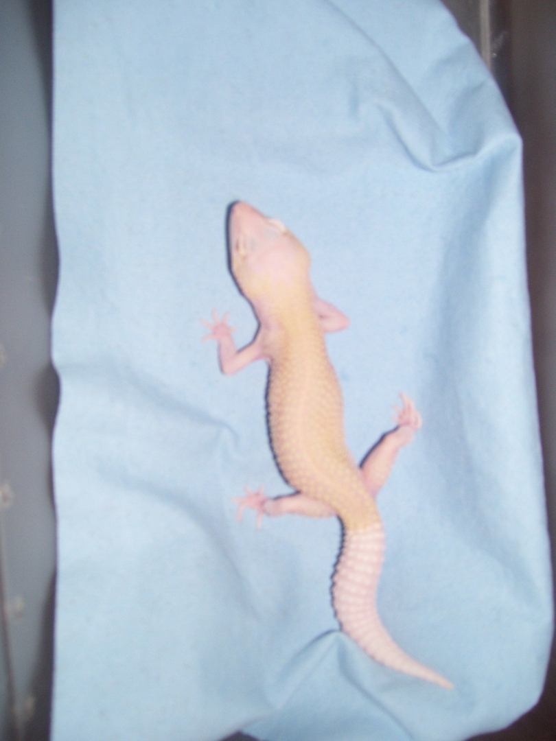 xanthic  150